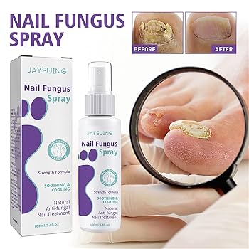 Nail Fungus Spray