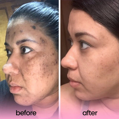 Turmeric Acid Cleaning Pads