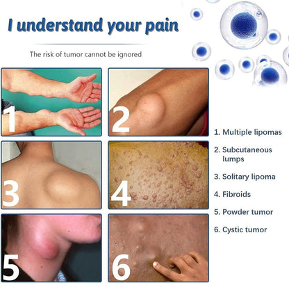 Lipoma Removal Spray (Original)