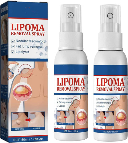 Lipoma Removal Spray (Original)