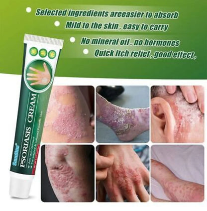 Summifun - Psoriasis Cream